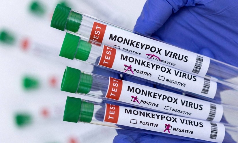 Các ống nghiệm có nhãn virus đậu mùa khỉ cho kết quả dương tính và âm tính. Ảnh: Reuters