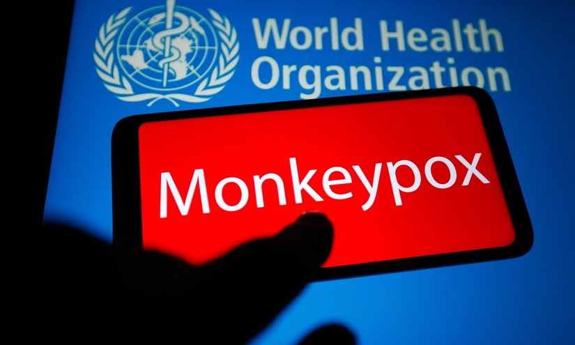WHO nói chưa cần tiêm vaccine ngừa bệnh đậu mùa khỉ hàng loạt. Ảnh: Global Times