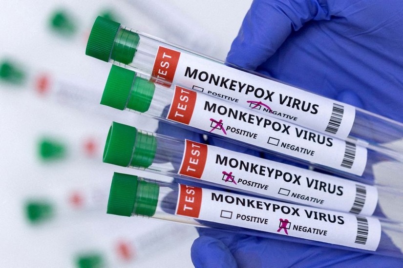 Các ống ghi kết quả xét nghiệm bệnh đậu mùa khỉ. Ảnh: Reuters