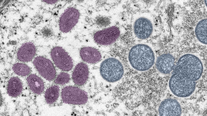 Virus đậu mùa khỉ đã trưởng thành (màu hồng) và chưa trưởng thành (màu xanh). Ảnh: CYNTHIA S. GOLDSMITH, RUSSELL REGNERY AND HANNAH BULLOCK/CDC