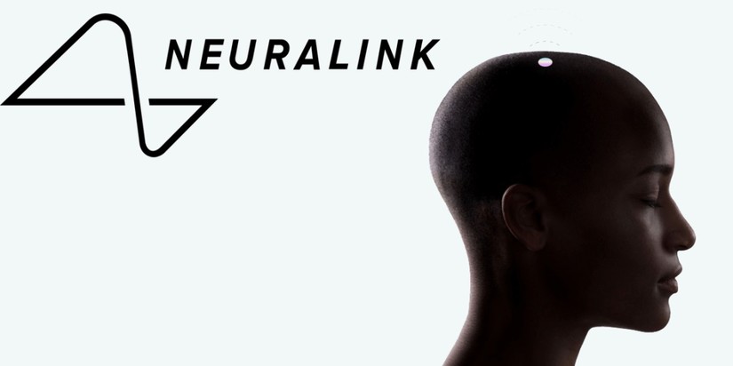 Tỷ phú Elon Musk khẳng định sẽ cấy chip não của Neuralink một khi công nghệ này sẵn sàng. 