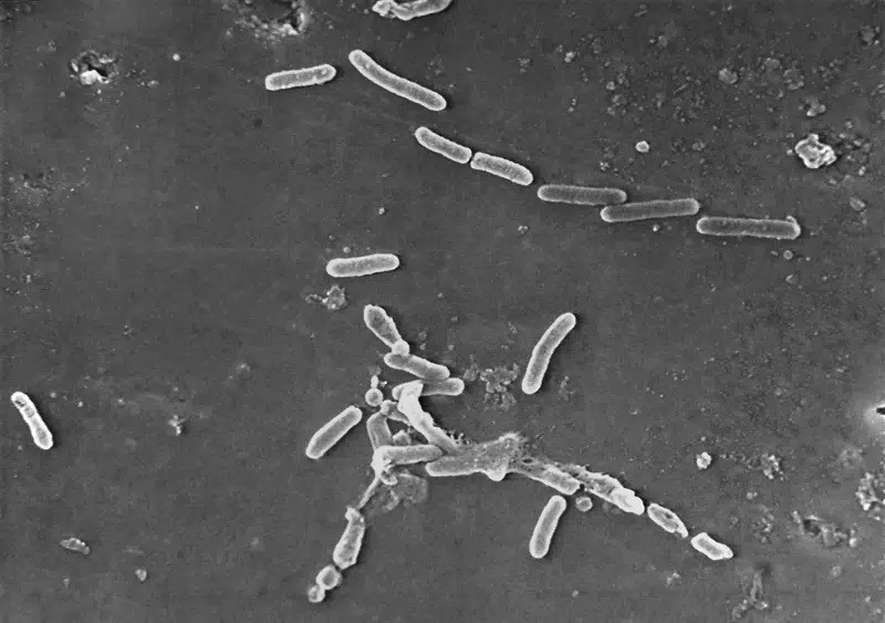Hình ảnh kính hiển vi điện tử của vi khuẩn Pseudomonas aeruginosa hình que. Ảnh: CDC Mỹ